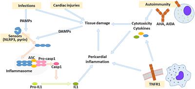 Recurrent Pericarditis in Children and Adolescents